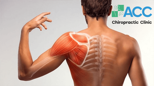 Đau nhức xương bả vai