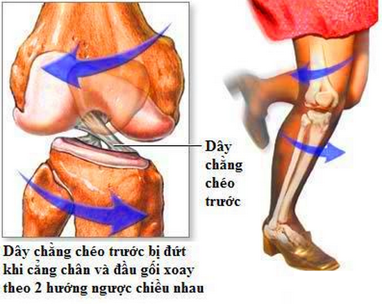 Cấu tạo dây chằng khớp gối
