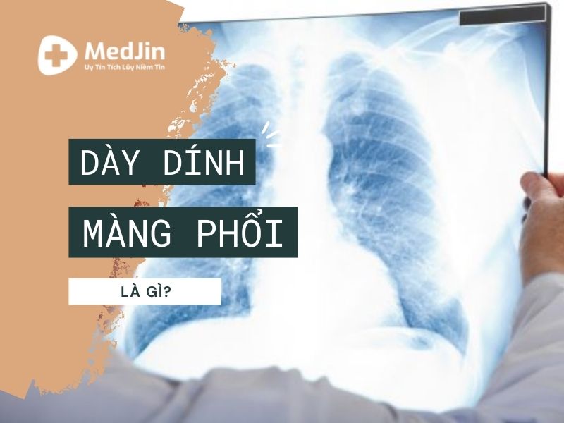 Dày dính màng phổi: Nguyên nhân, triệu chứng và cách điều trị hiệu quả 8 Minh họa dày dính màng phổi