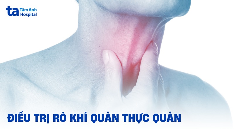 Phẫu thuật điều trị rò khí quản - thực quản