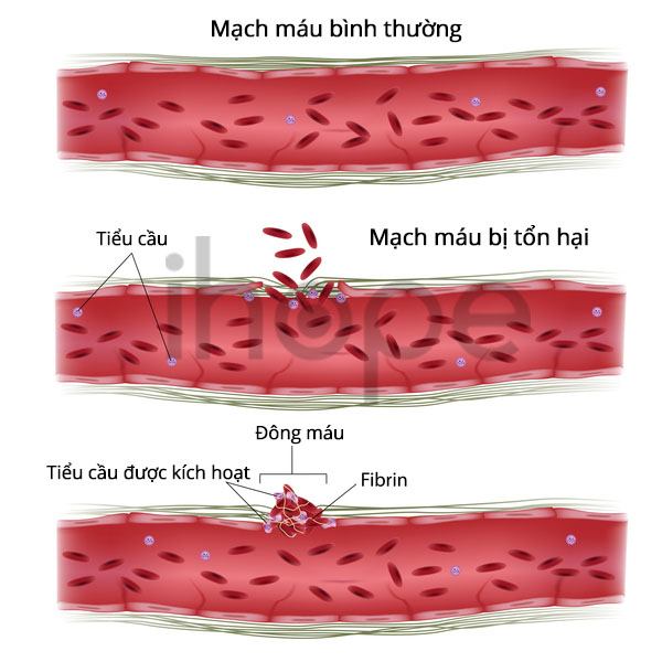 Cơ chế đông máu và bệnh Von Willebrand
