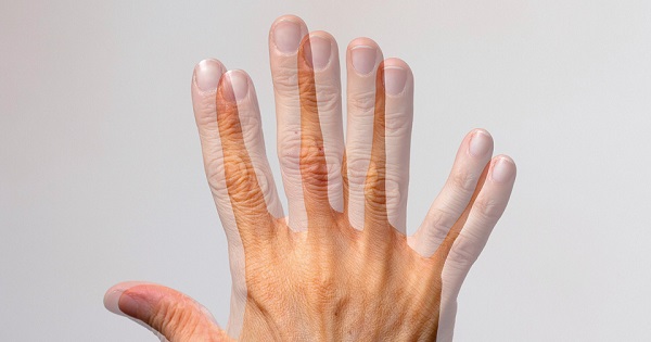 Dùng kính lăng trụ điều chỉnh nhìn đôi