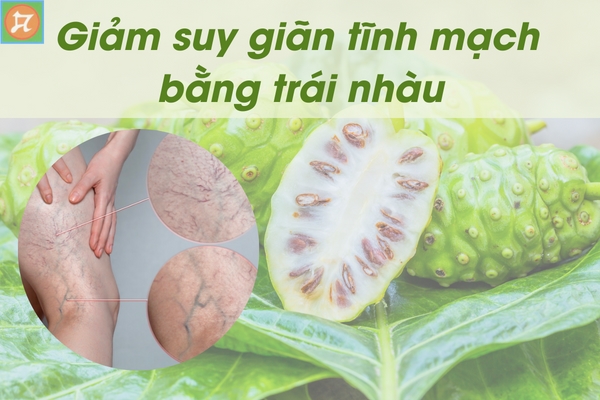sieu-am-thai-cham-tang-truong