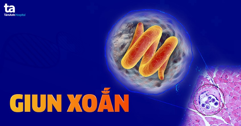 Bệnh Giun Xoắn: Nguyên Nhân, Triệu Chứng, Chẩn Đoán và Điều Trị 8 giun xoắn trong cơ