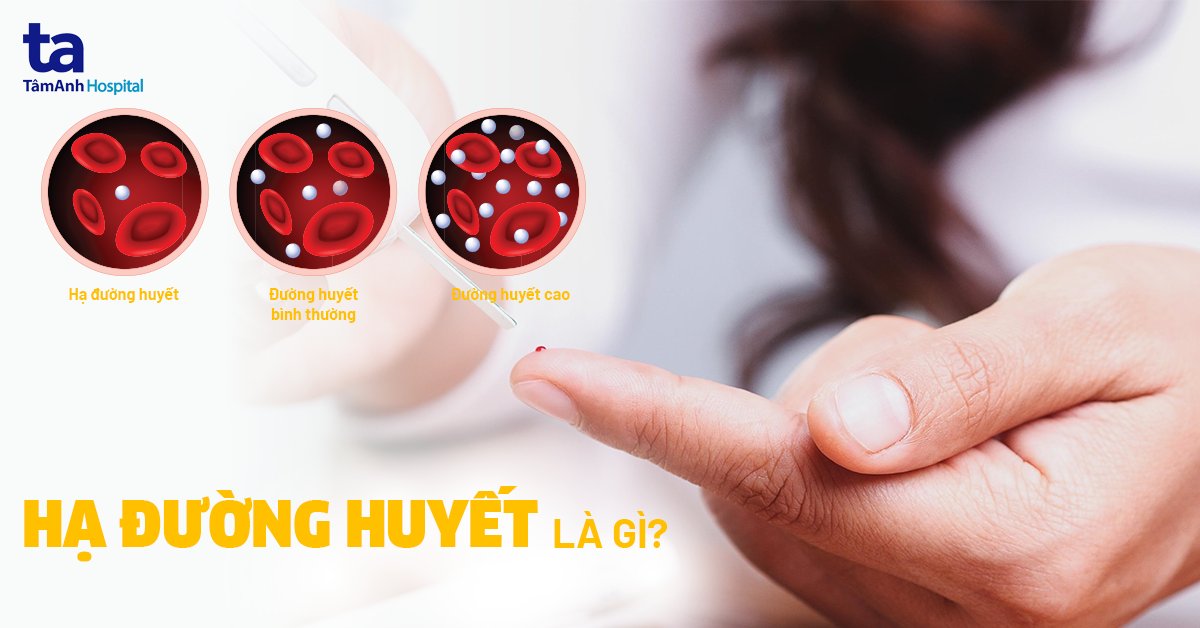 Hạ đường huyết là gì?