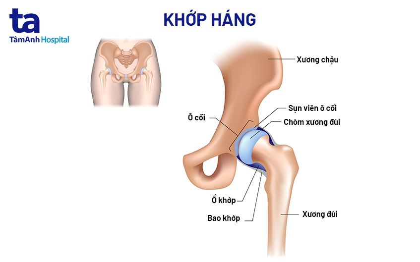Hình ảnh hẹp khe khớp háng minh họa