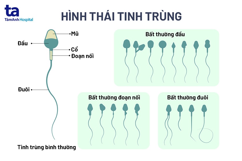 Hình thái của tinh trùng