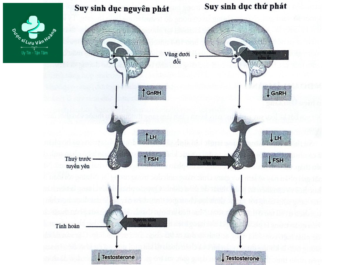 Tuyến yên và khối u