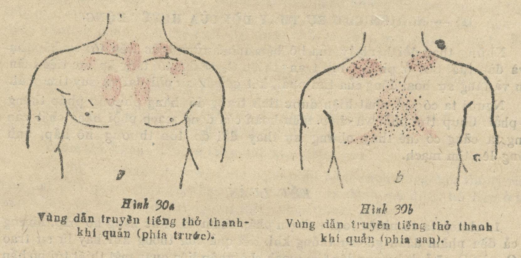 Hình ảnh X-quang màng phổi