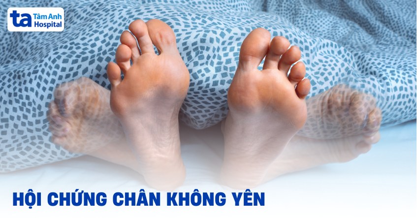 Hội Chứng Chân Không Yên: Cảm Giác Bứt Rứt Âm Ỉ Ảnh Hưởng Tới Giấc Ngủ Và Cuộc Sống 7 Người bệnh trằn trọc vì hội chứng chân không yên