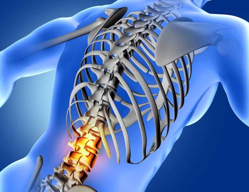 Hội chứng chèn ép tủy: Nguyên nhân, triệu chứng và phương pháp điều trị 7 Ảnh MRI hội chứng chèn ép tủy