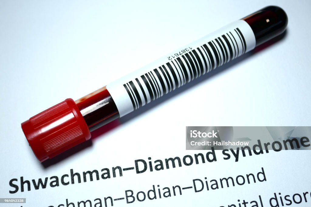 Hội Chứng Shwachman-Diamond: Bệnh Di Truyền Hiếm Gặp Ảnh Hưởng Tủy Xương Và Tuyến Tụy 2 Hình ảnh mô phỏng hội chứng Shwachman-Diamond