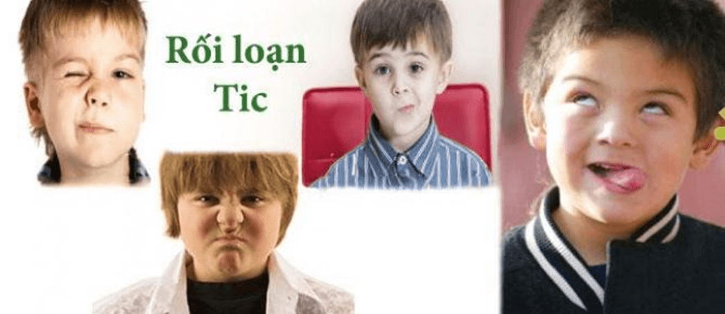 Triệu chứng Tic ở trẻ em
