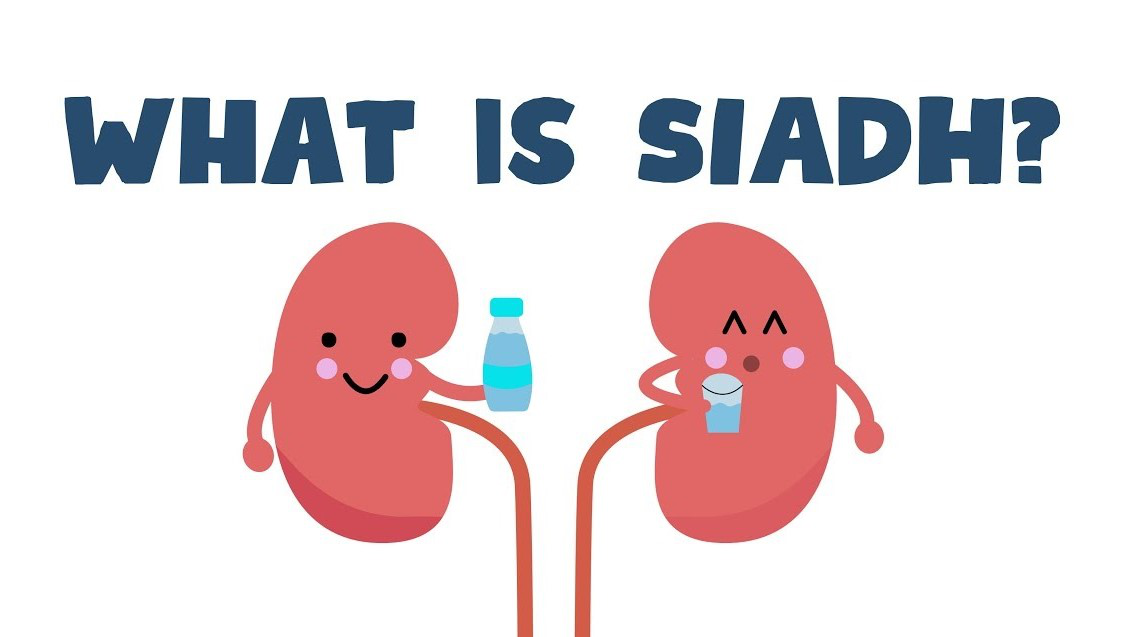 Hội chứng SIADH: Khi hormone chống bài niệu hoạt động sai cách 8 Nguyên nhân SIADH do thuốc và bệnh lý