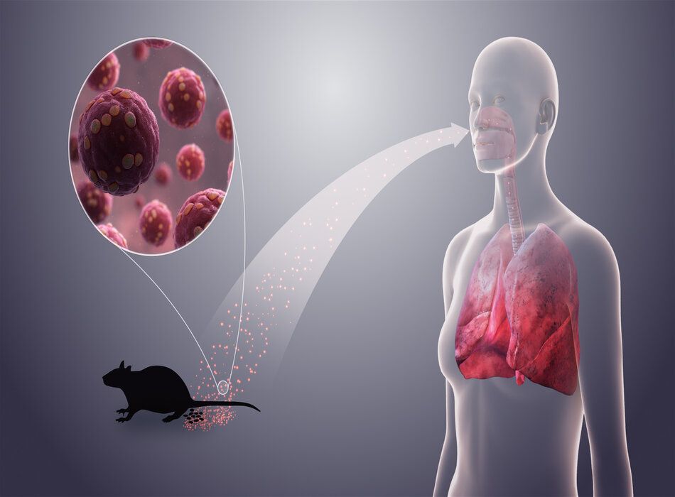 Triệu chứng virus Hanta