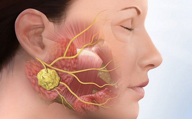 Ung thư xương hàm: Dấu Hiệu Nhận Biết, Nguyên Nhân Và Phác Đồ Điều Trị 2 image 10