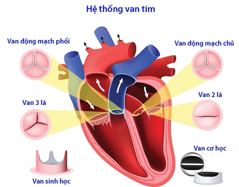 Bệnh van tim (Hẹp/hở van hai lá, van động mạch chủ): Hiểu đúng để điều trị hiệu quả 2 image 11
