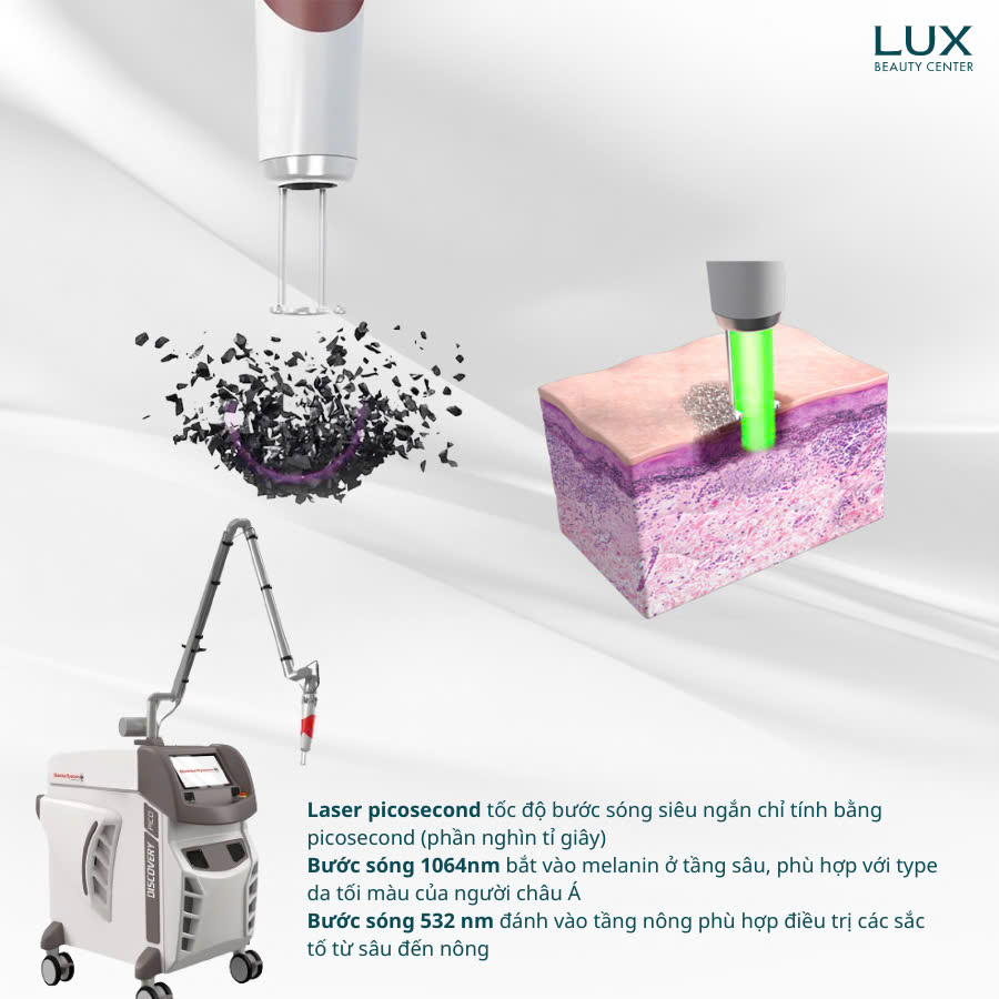 Laser Pico: Công nghệ xóa nám, tàn nhang, hình xăm hiện đại và hiệu quả 4 image 127