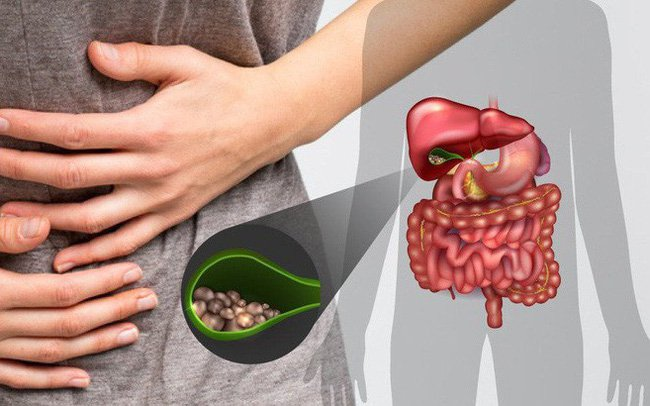 Ung thư túi mật: Từ triệu chứng âm thầm đến phương pháp điều trị hiệu quả 2 image 133