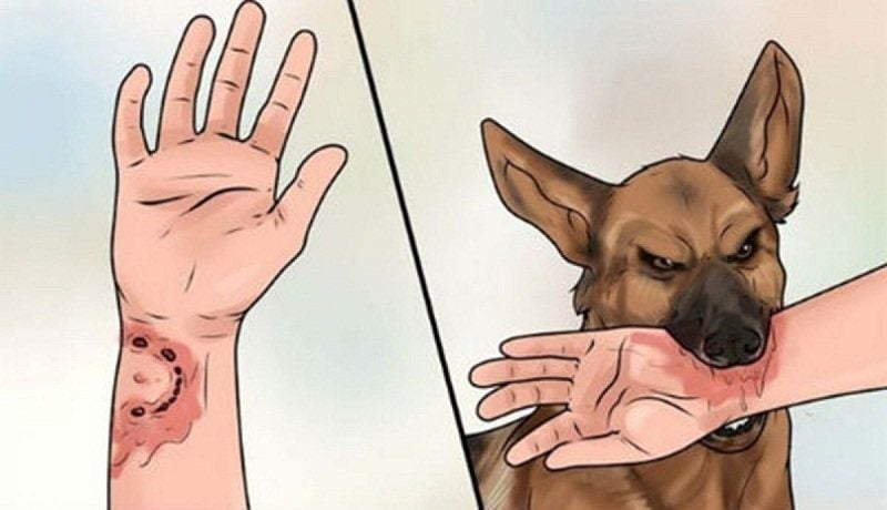 Bệnh Dại: Kiến Thức Cần Biết Về Căn Bệnh Nguy Hiểm Này 2 image 152
