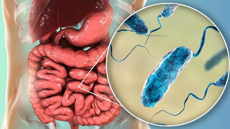 Bệnh Tả (Cholera): Nguyên Nhân, Triệu Chứng, Điều Trị và Phòng Ngừa 2 image 162