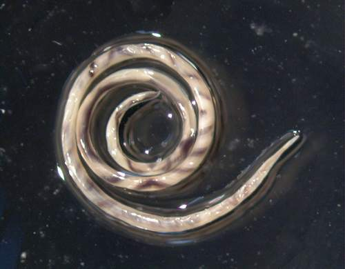 Bệnh do Angiostrongylus (Viêm màng não tăng bạch cầu ái toan) 8 image 168