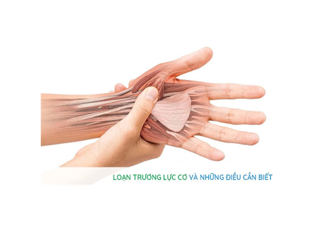 Loạn Trương Lực Cơ: Chẩn Đoán, Triệu Chứng và Phương Pháp Điều Trị Hiệu Quả 2 image 225