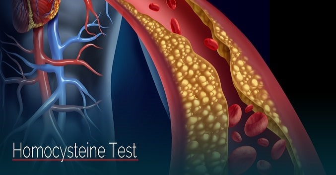 Tăng Homocysteine máu: Dấu hiệu tiềm ẩn của nhiều bệnh lý nghiêm trọng 3 image 46