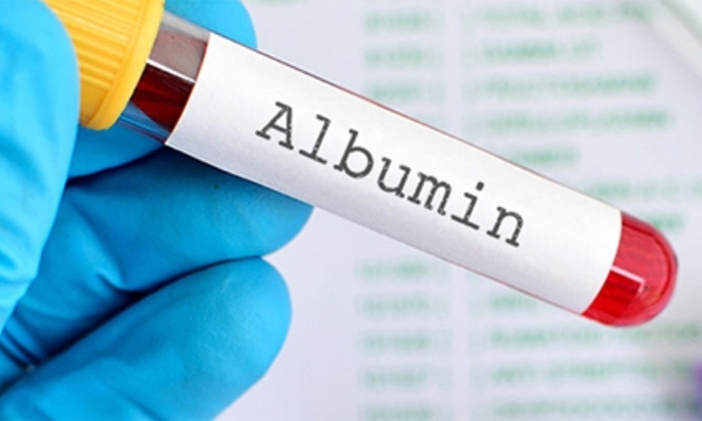 Albumin: Protein Quan Trọng Nhất Trong Huyết Tương 2 image 92