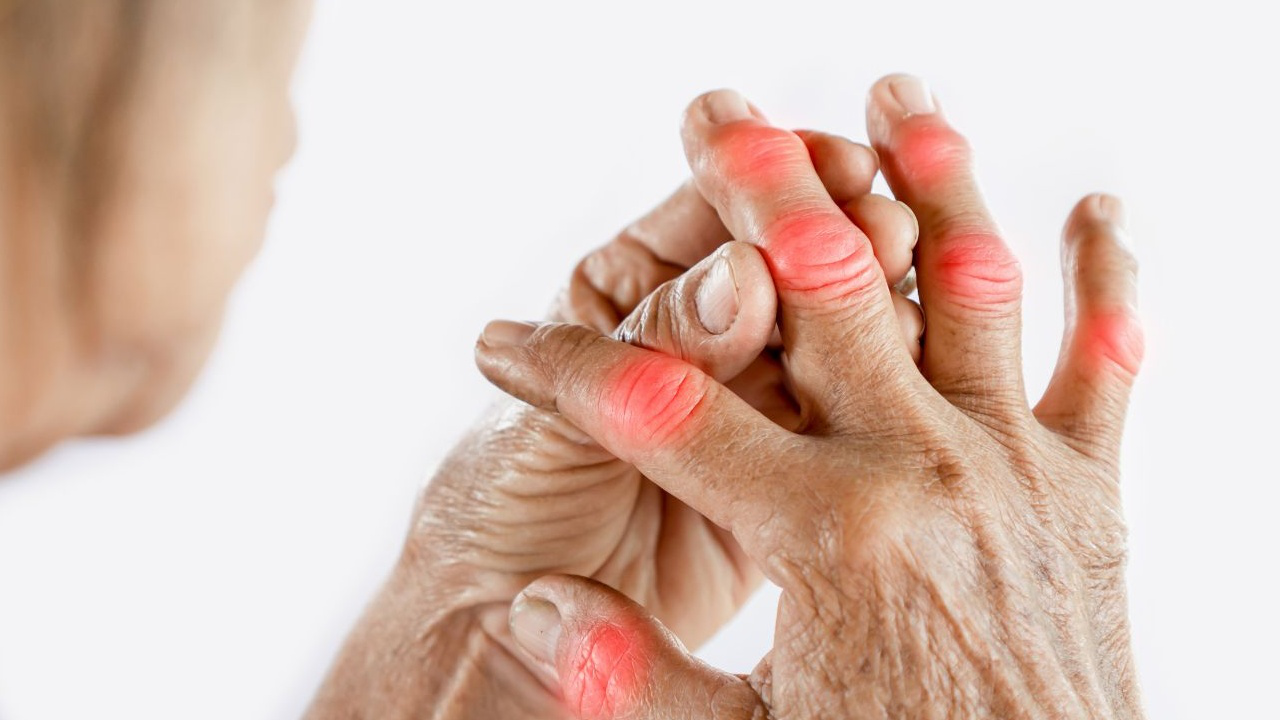 triệu chứng viêm khớp dạng thấp