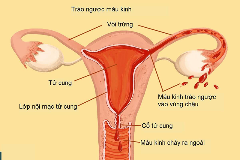lac-noi-mac-tu-cung.jpg