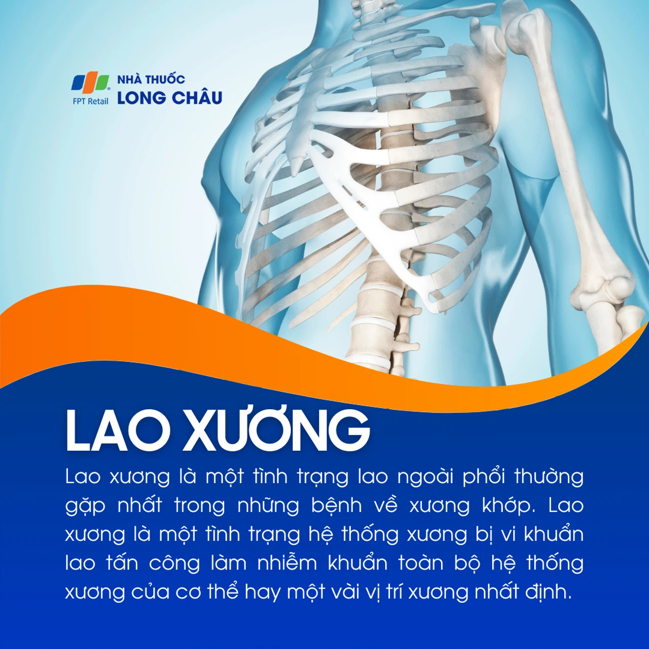 Ảnh chụp X-quang lao cột sống