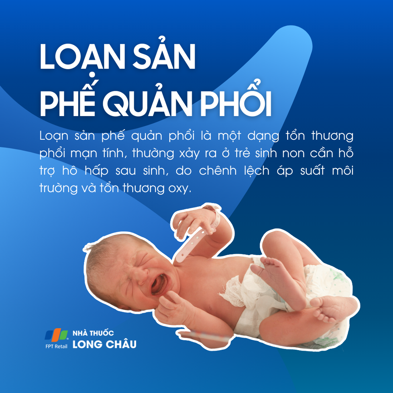 Trẻ sơ sinh thở máy bị BPD