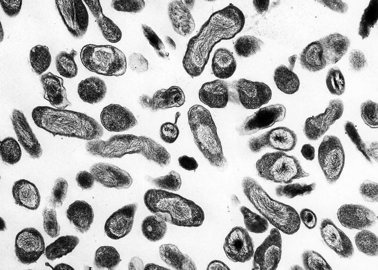 Sốt Q (Q Fever): Nguyên Nhân, Triệu Chứng, Cách Điều Trị và Phòng Ngừa Hiệu Quả 8 Vi khuẩn Coxiella burnetii dưới kính hiển vi