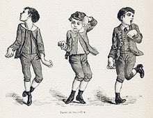 Minh họa rối loạn vận động múa vờn
