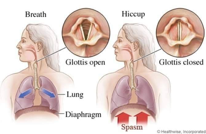 Nấc cụt phản xạ cơ hoành
