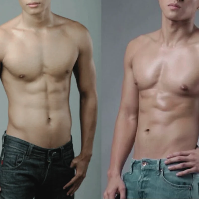 Nam giới sau khi tạo hình cơ bụng 6 múi