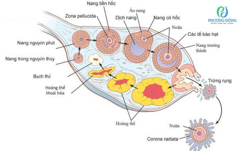 Nang hoàng thể buồng trứng