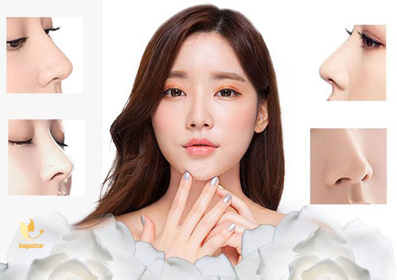 Nâng mũi cấu trúc là gì? Phân biệt với nâng mũi bán cấu trúc 8 so sánh nâng mũi cấu trúc và bán cấu trúc