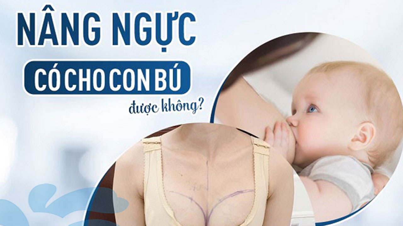 Nâng ngực có cho con bú được không