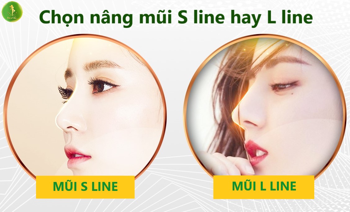 Nâng mũi S-Line hay L-Line