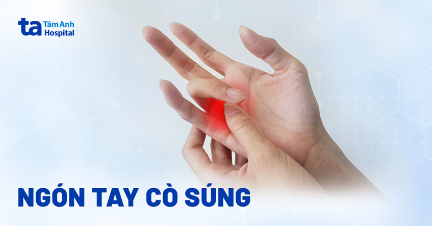 Ngón tay cò súng