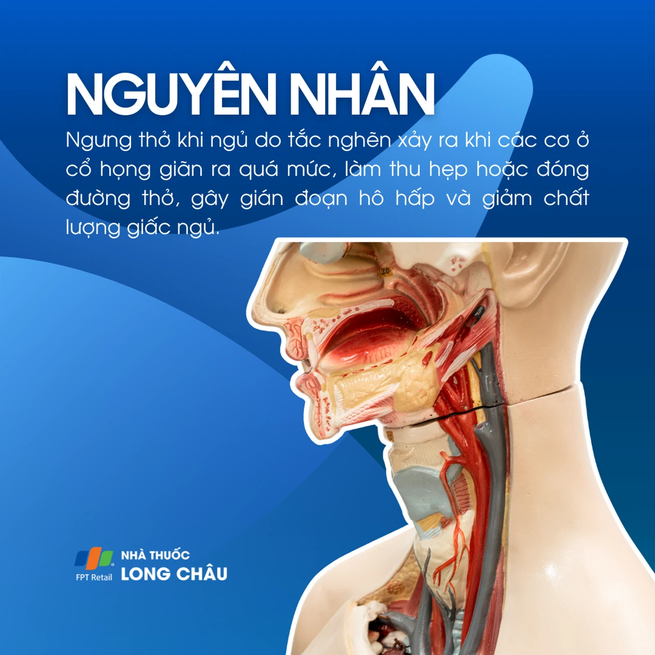 Chẩn đoán ngưng thở khi ngủ bằng máy đo