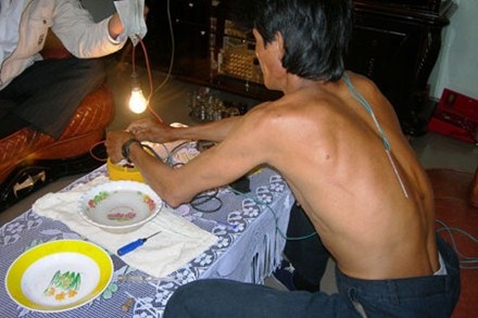 Bệnh nhân không thể nhận biết vật bằng sờ