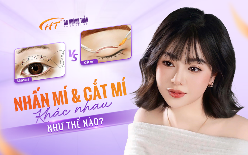 So sánh cắt mí và nhấn mí