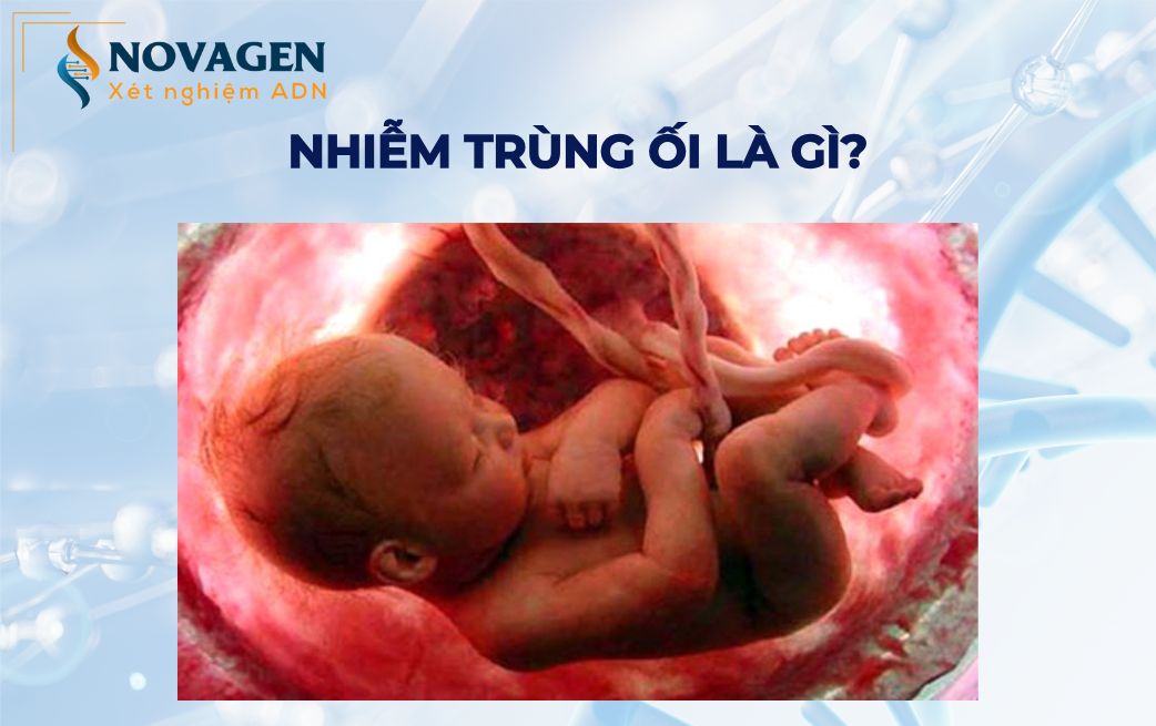 Nhiễm Trùng Ối: Nguy Cơ, Triệu Chứng Và Hướng Điều Trị Kịp Thời 7 Hình ảnh mô phỏng nhiễm trùng ối