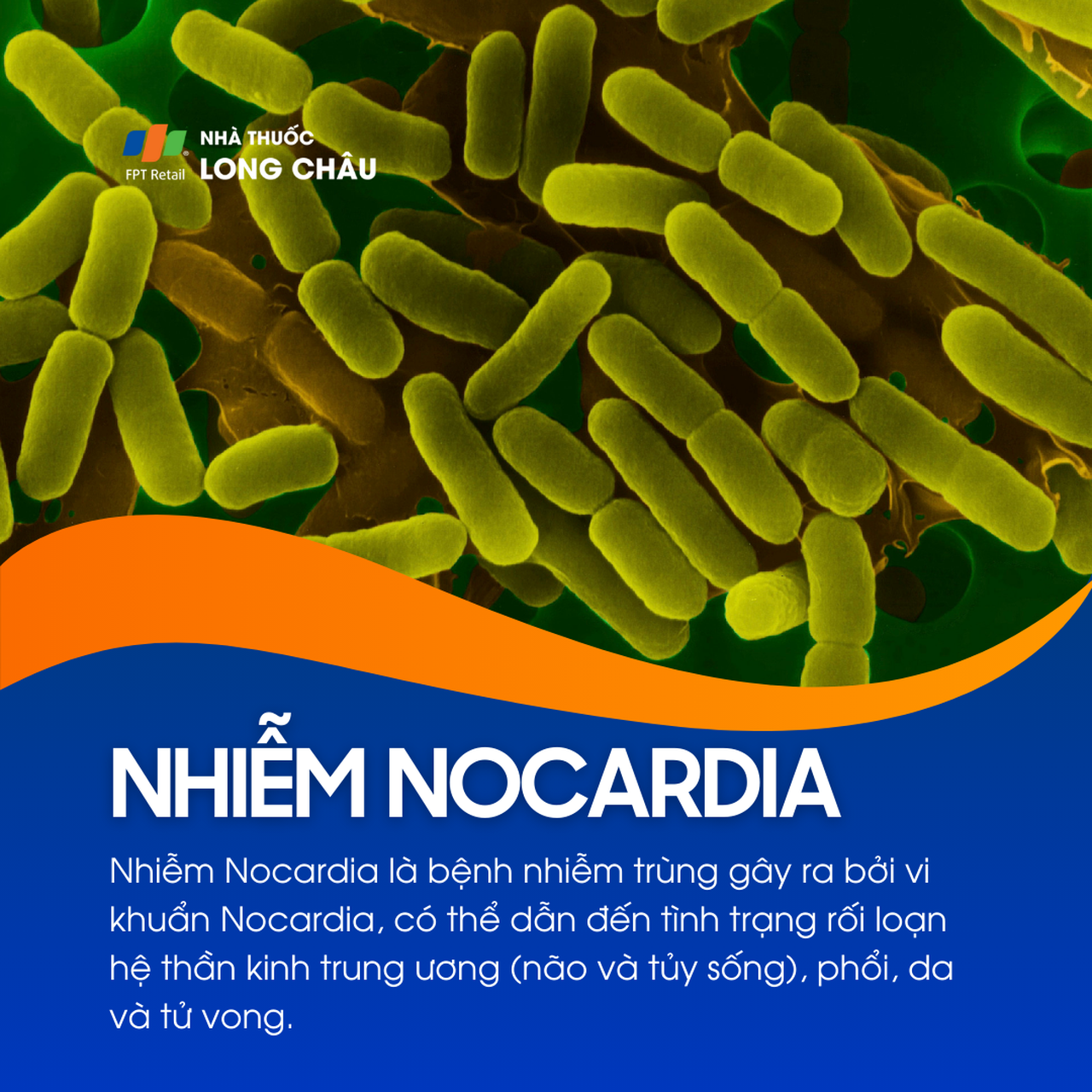 Tổn thương do nhiễm Nocardiosis ở nhiều cơ quan