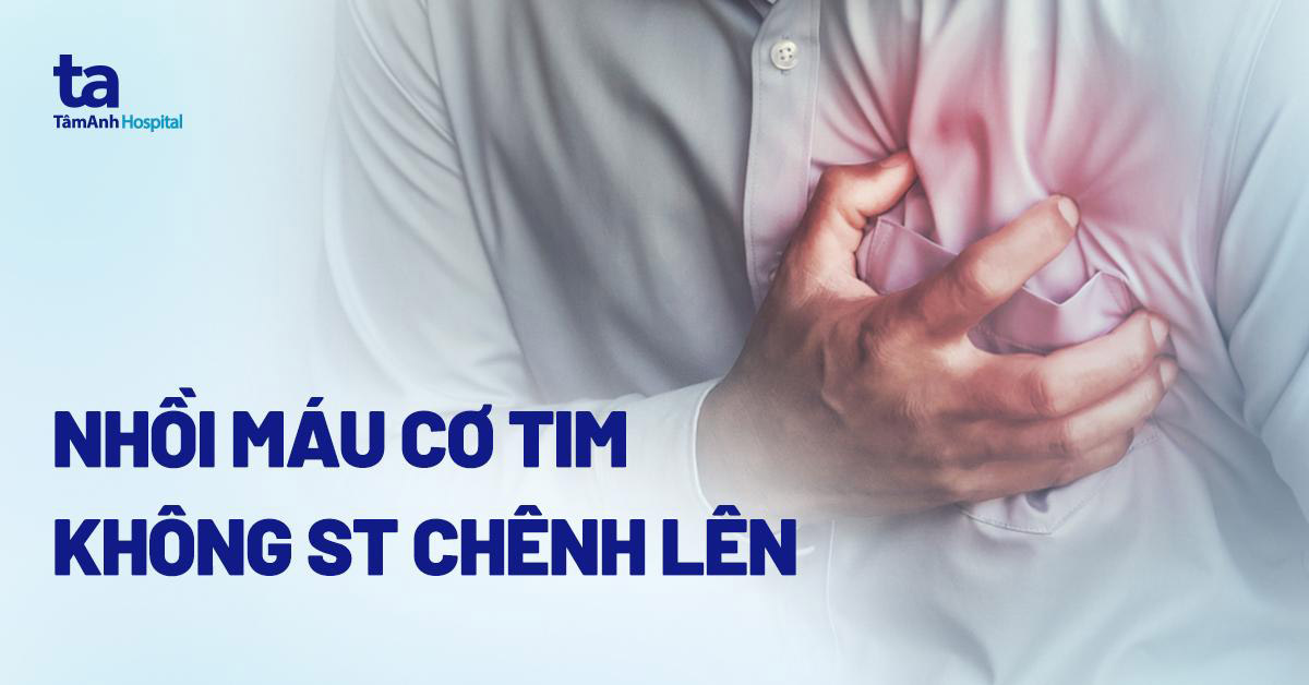 Nhồi máu cơ tim không ST chênh lên là gì