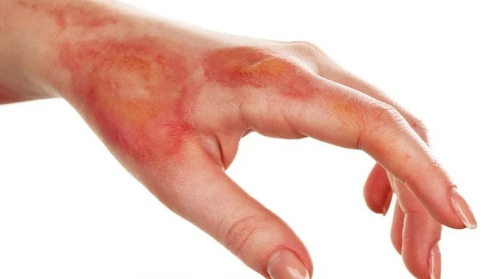 Hạ magnesi máu: Hiểu đúng để xử trí hiệu quả 7 Nguyên nhân gây hạ magnesi máu