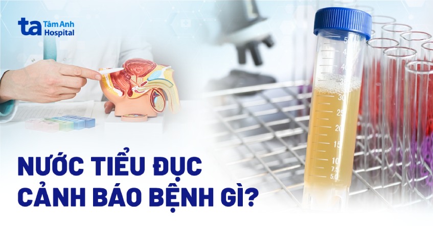 nước tiểu đục là gì